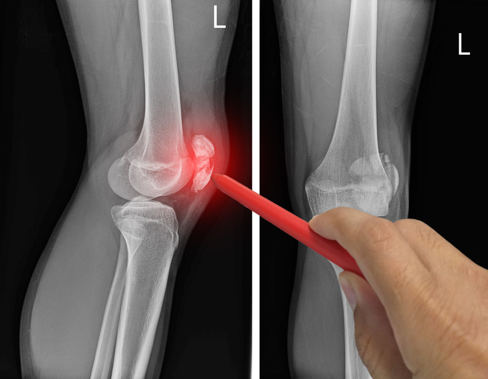 X-ray services Lebanon, TN 